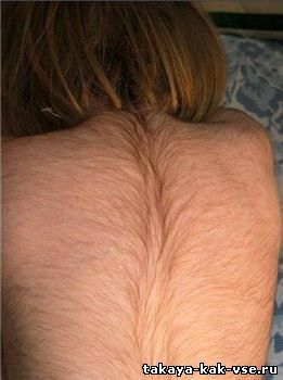 волосатая женская спина